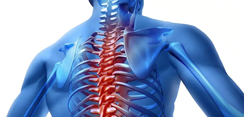 Whiplash Injury Compensation in Kentucky